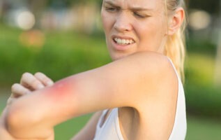 femme s'étant fait piquer le bras